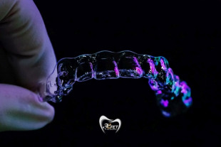 «Прозрачная» ортодонтия