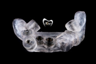 Навигационная имплантация