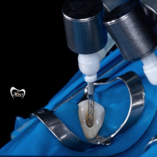 Лечить каналы могут все, но…